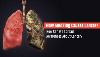 How Smoking Causes Cancer? How Can We Spread Awareness About Cancer?